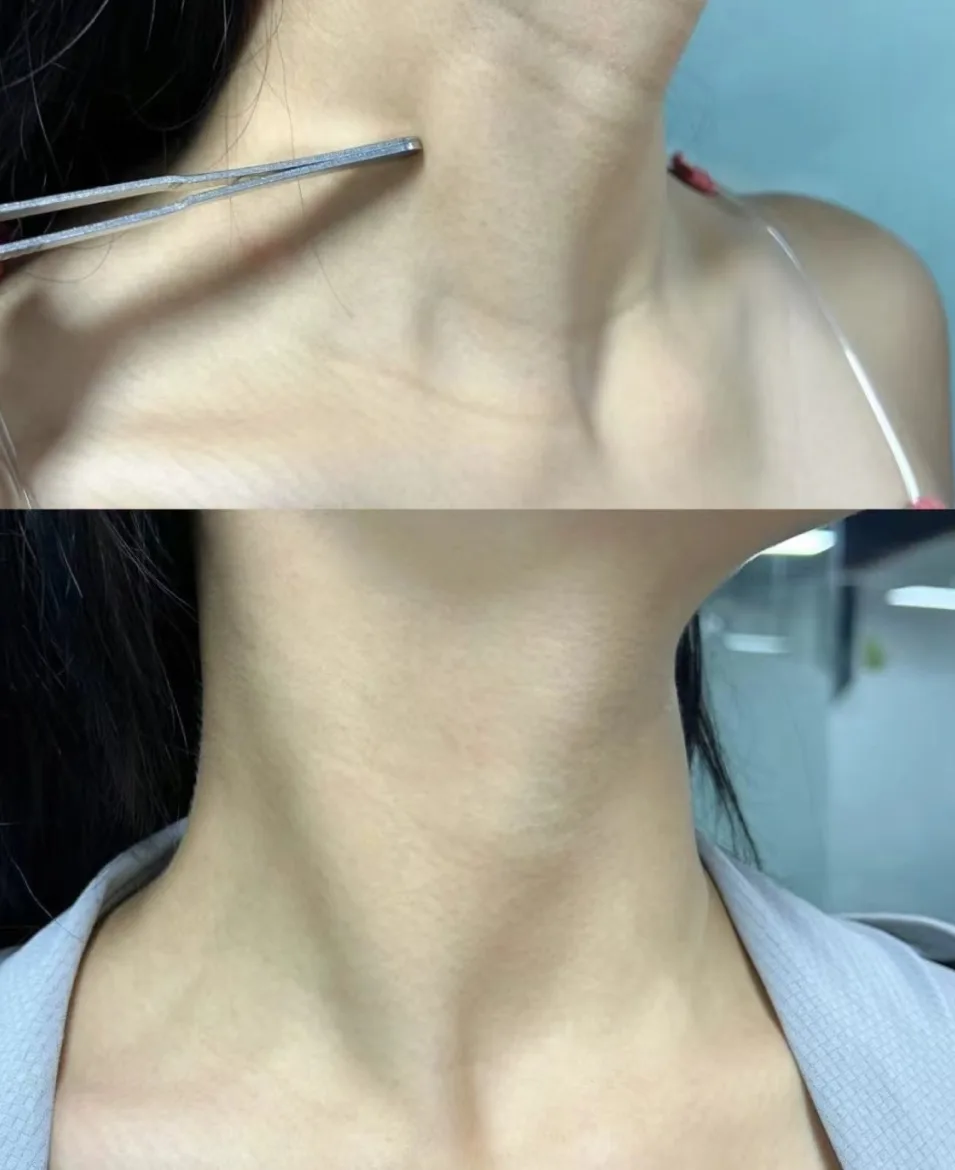 neck-11