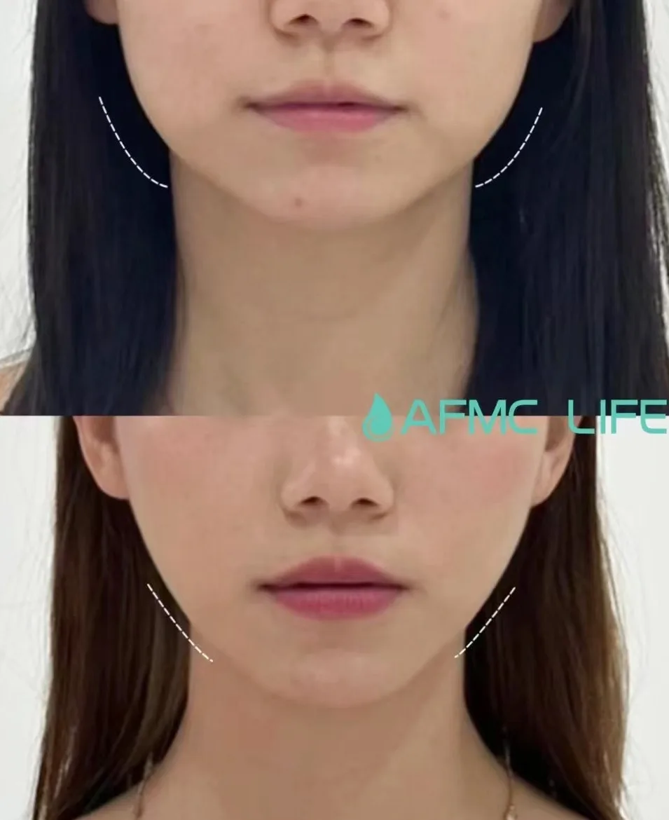 neck-2