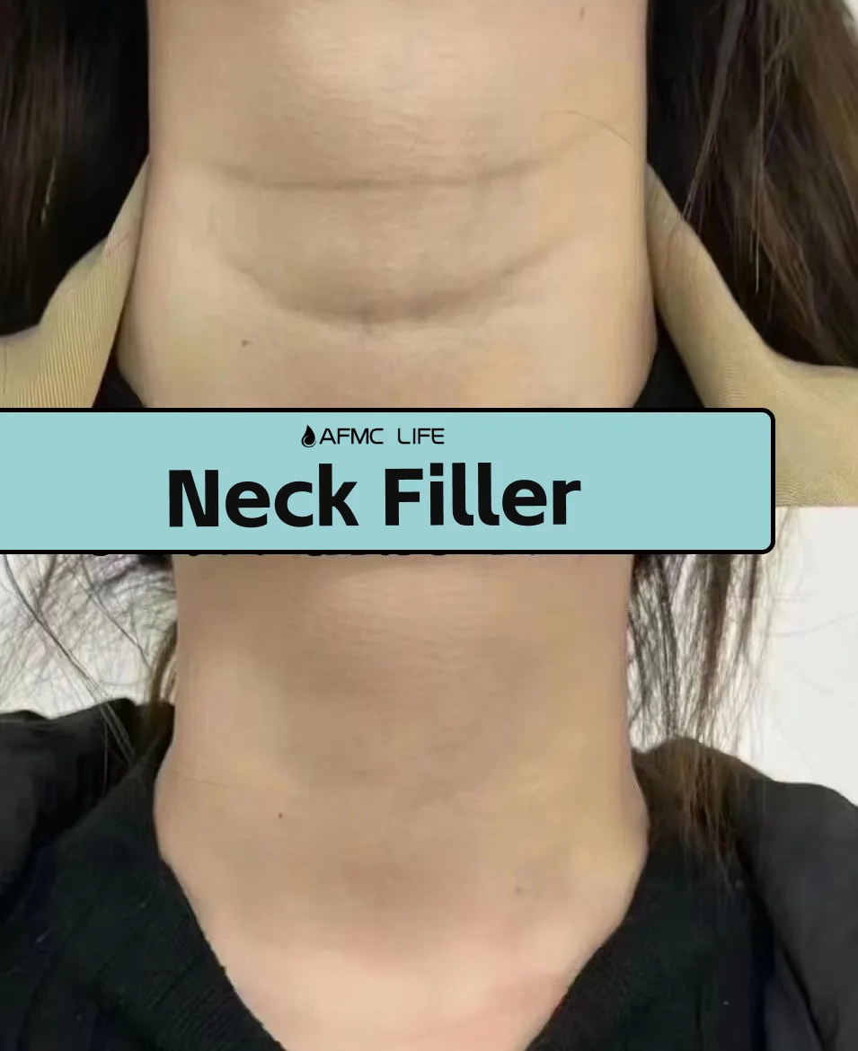 neck